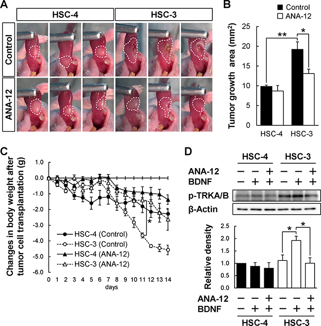 Reduced HSC-3 tumor growth in mice administrated a TRKB-specific inhibitor.