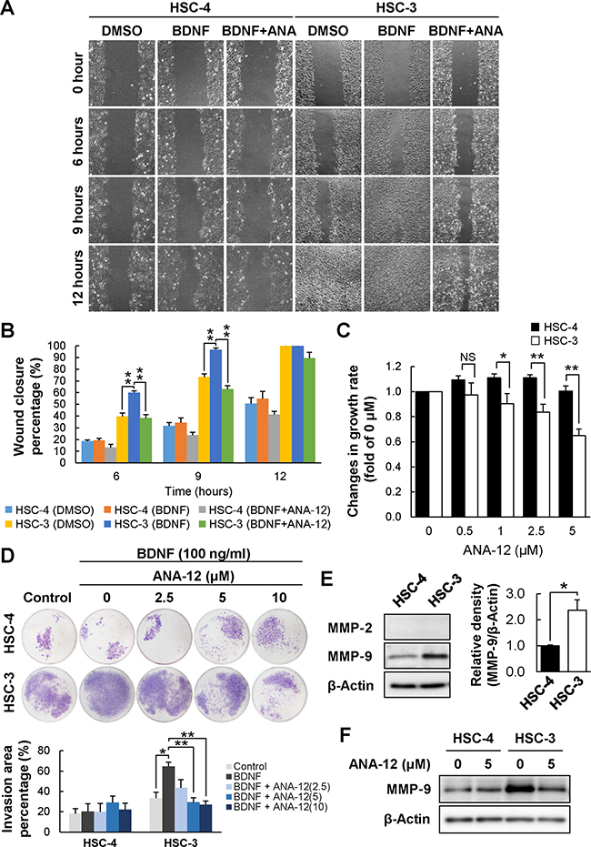 Reduced cell migration and proliferation of HSC-3 following treatment with a TRKB-specific inhibitor.