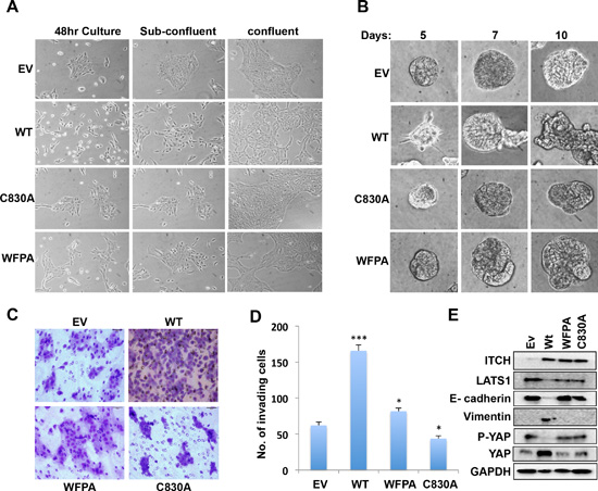 Effect of ITCH expression on EMT in MCF10A cells.