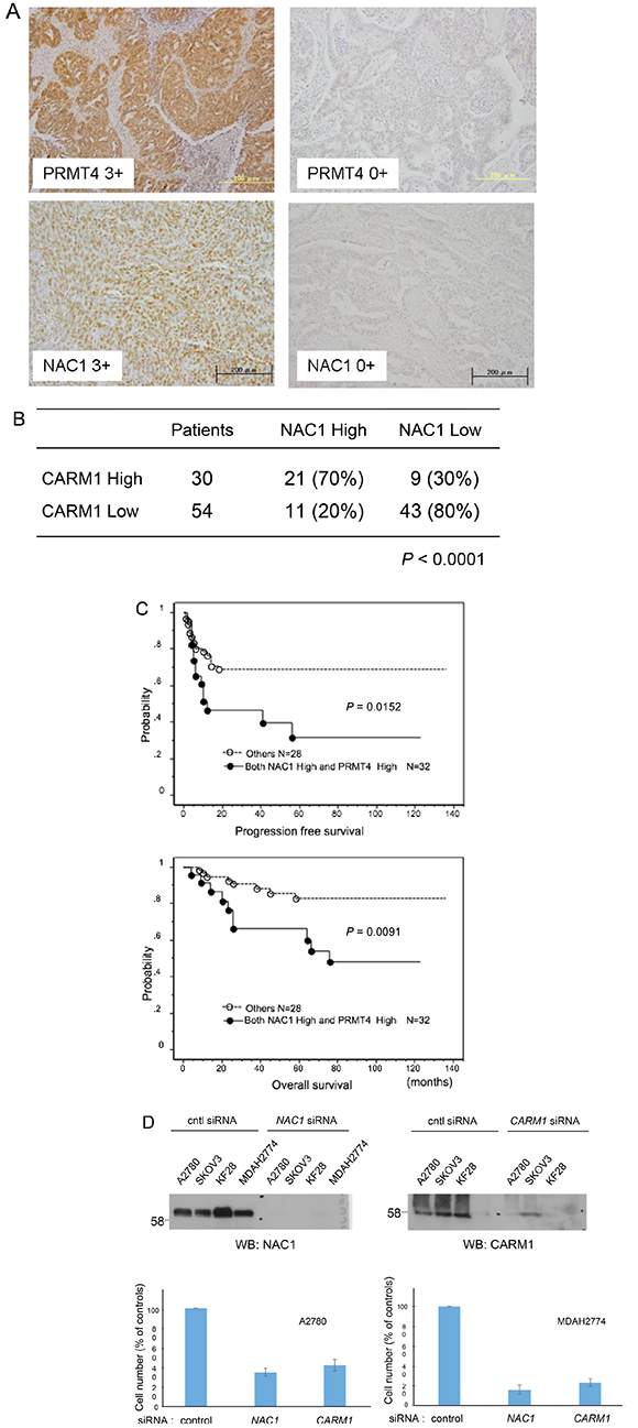 Co-upregulation of CARM1 and NAC1 in ovarian carcinoma tissues.