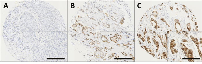 Representative photomicrographs following immunohistochemical staining