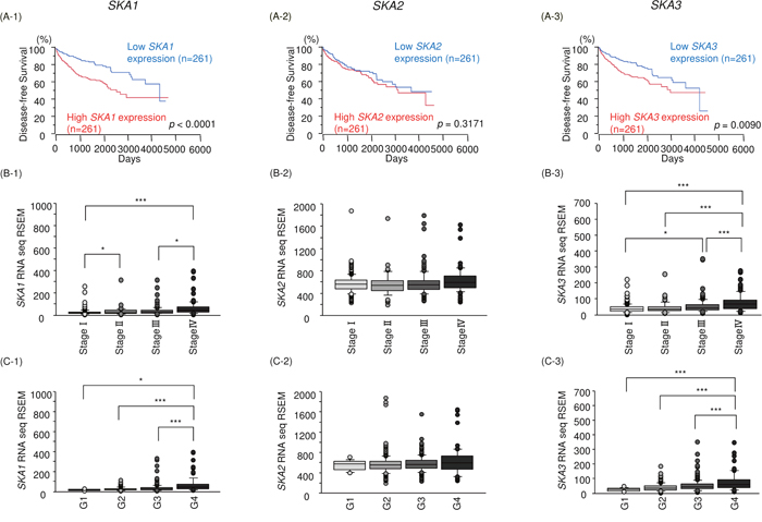 Relationships between expression levels of SKA1, SKA2 and SKA3 and disease-free survival, tumor stage and histological grade.