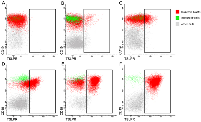 Flow cytometry profiles showing different CRLF2 expression patterns on leukemic blasts in the pediatric BCP-ALL patients.