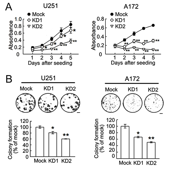 Reduction of cell growth and colony formation ability in U251 and A172 cells by BRCC3 knockdown.