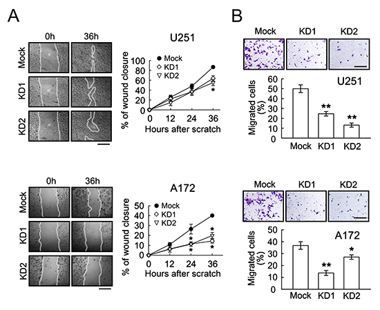 Decrease of cell migration and invasion in U251 and A172 cells by BRCC3 knockdown.