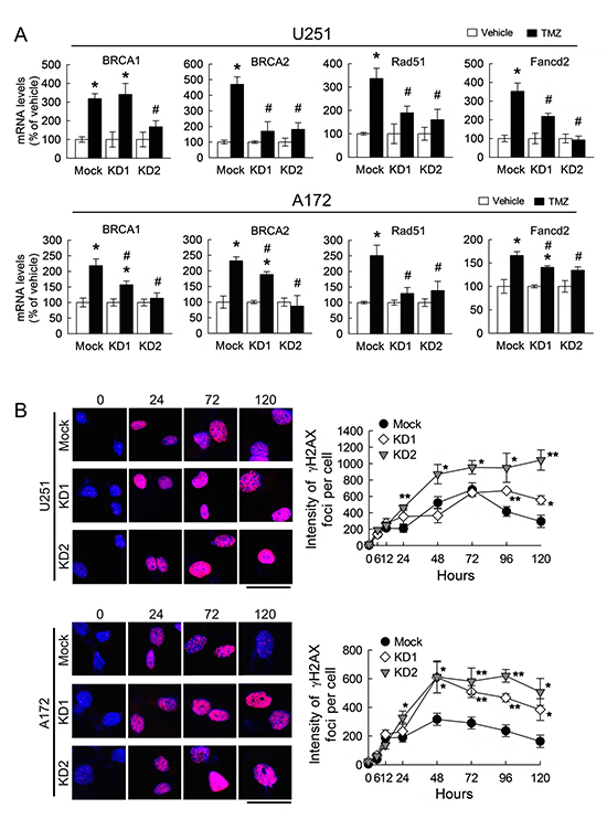 Downregulation of BRCC3 expression alleviates DNA repair ability in U251 and A172 cells.