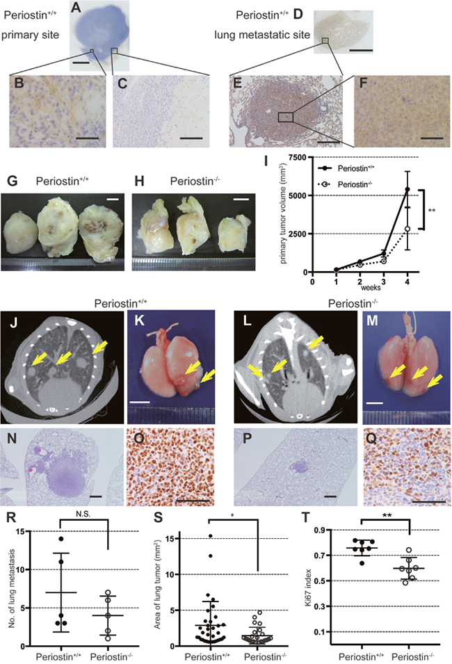 Periostin promotes lung-cancer proliferation in vivo.