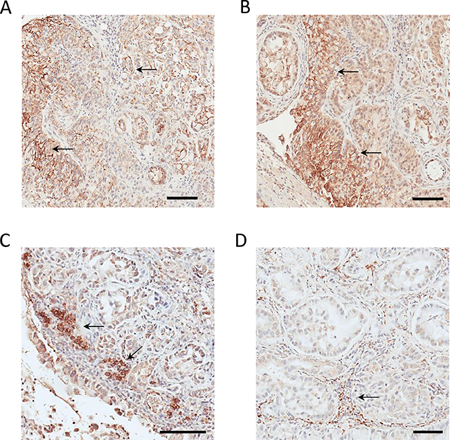 Cross-validation of parenchymal CD44 and CDH17 expression and stromal PD-L2 and ORL-1 expression in tumor xenograft tissue.