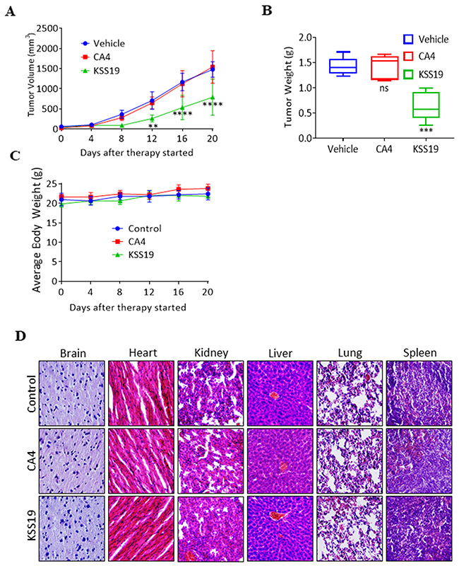 KSS19 suppresses colon tumor xenograft growth rate in nude mice.