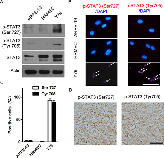 STAT3 is activated in retinoblastoma cells and in vivo orthotopic tumors.