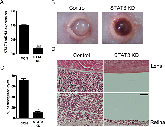 Intravitreal administration of STAT3 siRNA suppresses in vivo formation of orthotopic tumors.