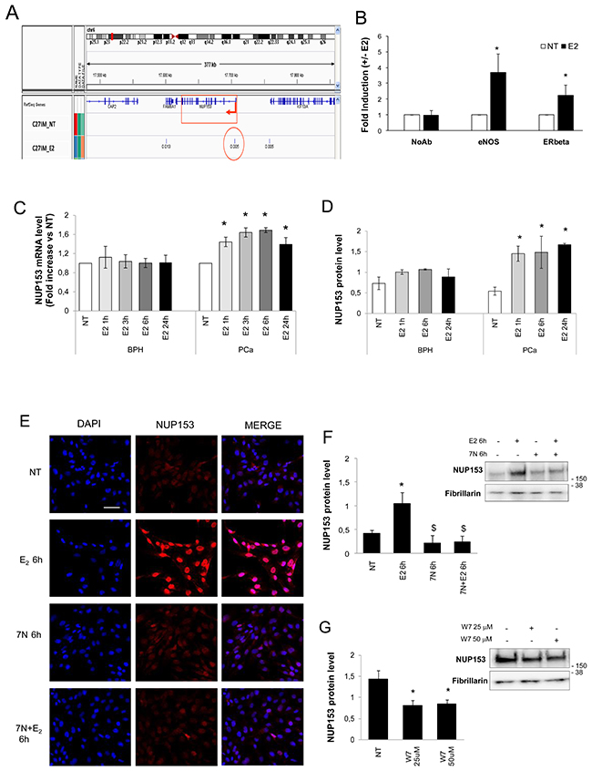 eNOS binds Nup153 promoter and regulates its expression in an estrogen-dependent manner.