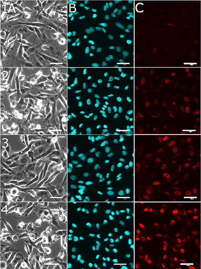 Representative confocal microscopic images recorded for detection of DNA damage in cancerous MDA-MB-231 cells.