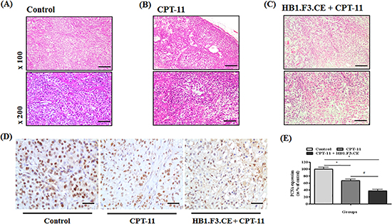 Immunohistochemical (IHC) staining and hematoxylin and eosin (H&#x0026;E) staining.