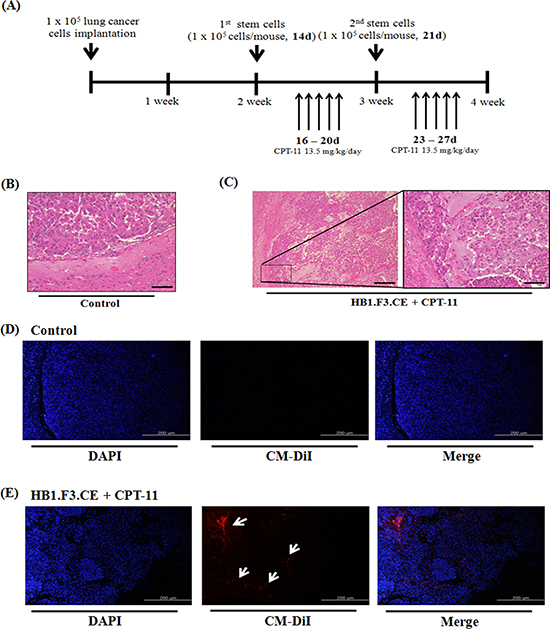 Histopathological analysis and tumor-tropic effect of stem cells in metastatic lung cancer animal models.