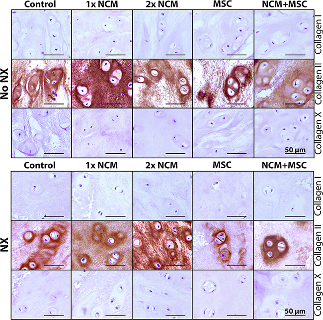 Notochordal cell-derived matrix (NCM) stimulates collagen type II, but no collagen type I or X deposition in the canine nucleus pulposus (NP) in vivo.
