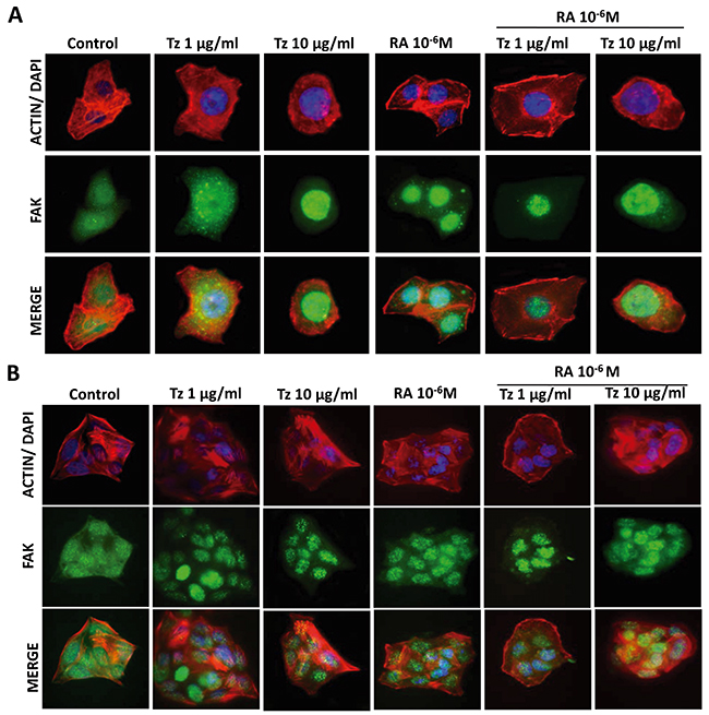 Tz and RA induce FAK nuclear localization.