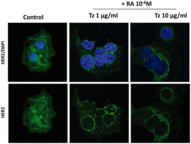 Tz and RA induce HER2 internalization.