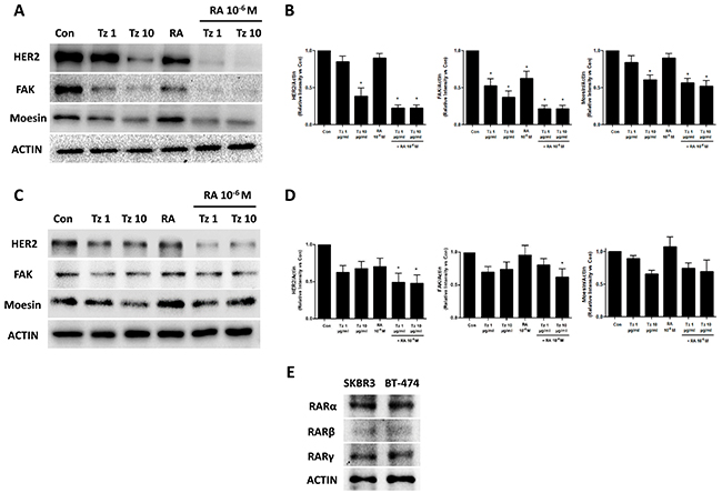 Tz and RA reduce HER2, FAK and Moesin expression.