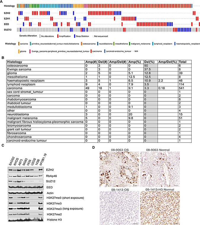 Genetic alterations of PRC2 components in osteosarcoma cell lines.