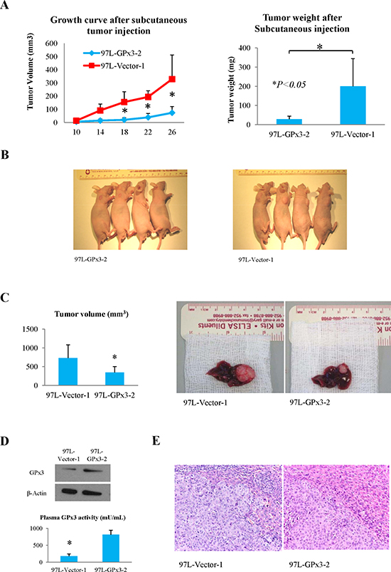 Effects of over-expression of GPx3 on tumor growth in nude mice ectopic and orthotopic liver cancer model.