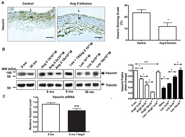 Age decreases vasorin expression in aortic wall or VSMCs via Ang II signaling.