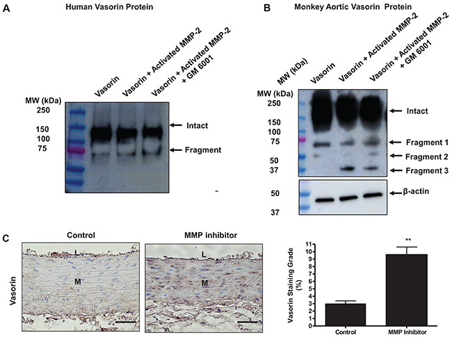 Vasorin is an MMP-2 substrate.