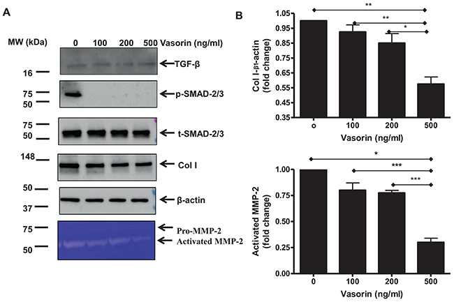 TGF-&beta;1 downstream profibrotic effects in old VSMCs regulated by recombinant human vasorin proteins.