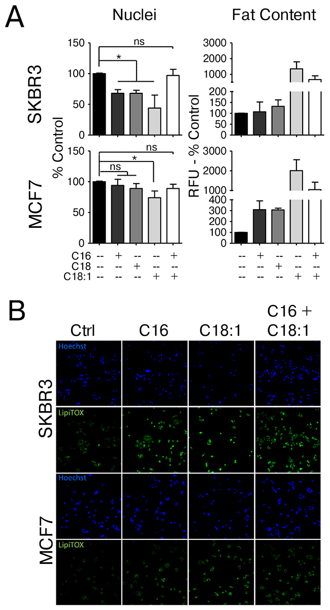 HER2/neu-positive SKBR3 and HER2-normal MCF7 cells differ in their response to saturated fatty acid supplementation.
