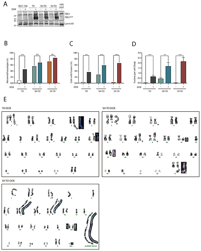 TRF2&Delta;B&Delta;M expression induces chromosome end-to-end fusions in all inducible cell lines.