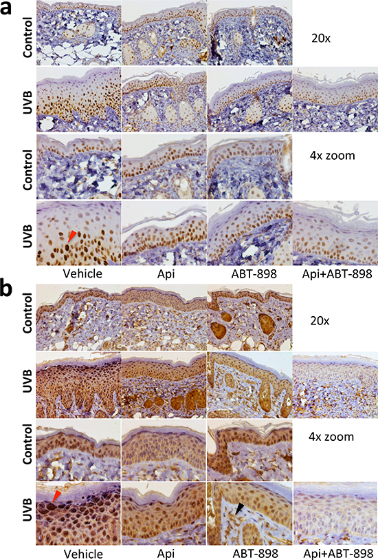 ABT-898 inhibits the induction of HIF pathway by UVB in epidermal keratinocytes.