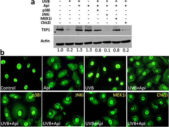HuR-translocation and recovery of TSP1 expression by apigenin requires Chk2 kinase.
