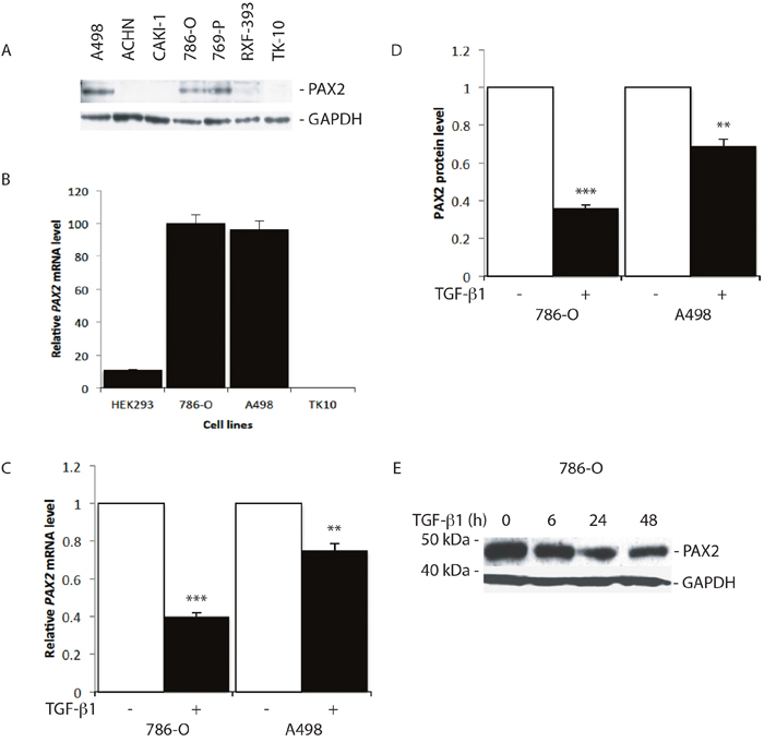 TGF-&beta;1 treatment suppresses PAX2 mRNA and protein expression in CC-RCC cell lines.