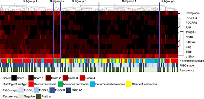 Hierarchical cluster analysis of ovarian cancer including serous carcinoma, MC, EC and CCC based on the protein expression patterns of cancer-associated fibroblasts (CAFs) and cells undergoing the EMT.