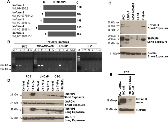 Analysis of the expression of TNFAIP8 isoforms in cancer cell lines.