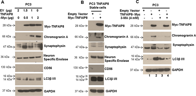 TNFAIP8 increases the expression of NED biomarkers in prostate cancer PC3 cells.