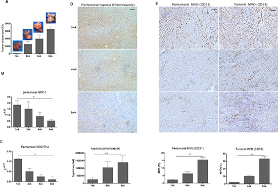 Peritumoral NRP-1 and VEGFR-2 expression, hypoxia level and MVD, as well as tumoral MVD in the 6wk of tumor growth in a mouse orthotopic xenograft model bearing human HCC-LM3 cells.