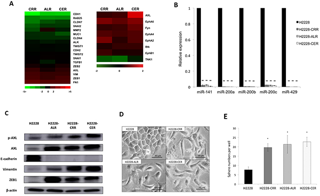 AXL overexpression with EMT features in ALK-TKI&#x2013;resistant cells.