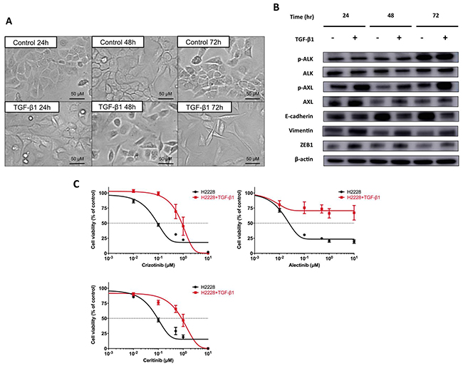 EMT changes and resistance to ALK-TKIs in H2228 cells exposed to TGF-&#x03B2;1.