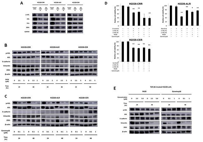 Reversal of EMT and ALK-TKI&#x2013;resistance by R428 and ganetespib in ALK-TKI&#x2013;resistant H2228 cells and H2228 cells exposed to TGF-&#x03B2;1.