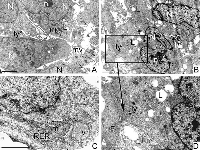 Ultrastructural analysis of GCSCs.