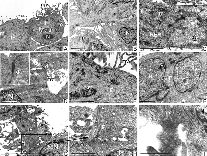 Ultrastructural analysis of PCSCs.