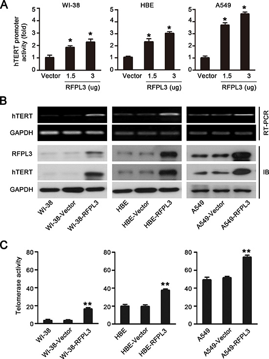 Overexpression of RFPL3 up-regulates hTERT promoter acivation and promotes hTERT expression and telomerase activity.
