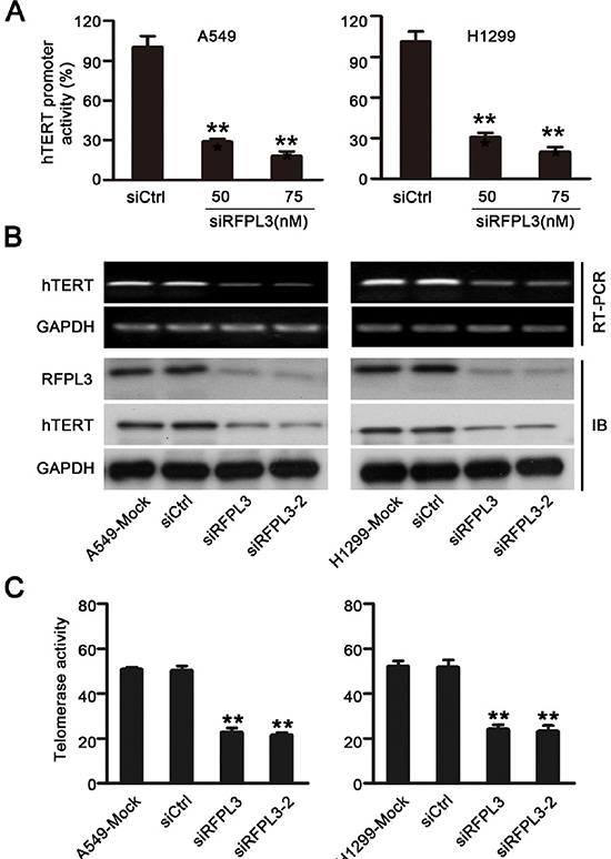 Knockdown of RFPL3 inhibits hTERT promoter activation and decreases hTERT expression and telomerase activity.