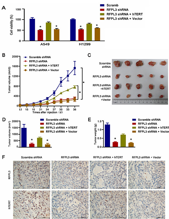 Knockdown of RFPL3 inhibits tumor growth by downregulating hTERT expression in vitro and in vivo.