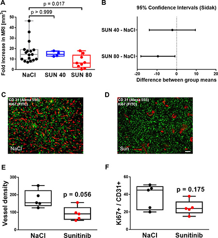 Sunitinib treatment successfully reduces angiogenesis and tumor growth in orthotopic glioma while inducing vascular resistance.