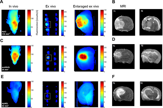 NIRF imaging allows non-invasive molecular imaging of glioma microcirculation.