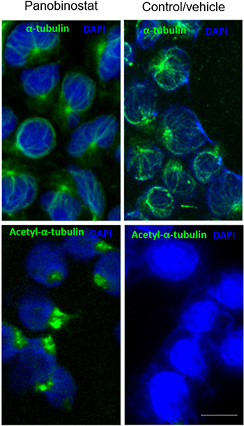 Panobinostat cytotoxicity is linked to &#x03B1;-tubulin acetylation.