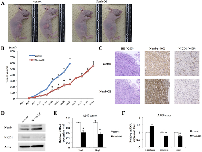 Effect of Numb overexpression on A549 subcutaneous tumor formation in vivo.