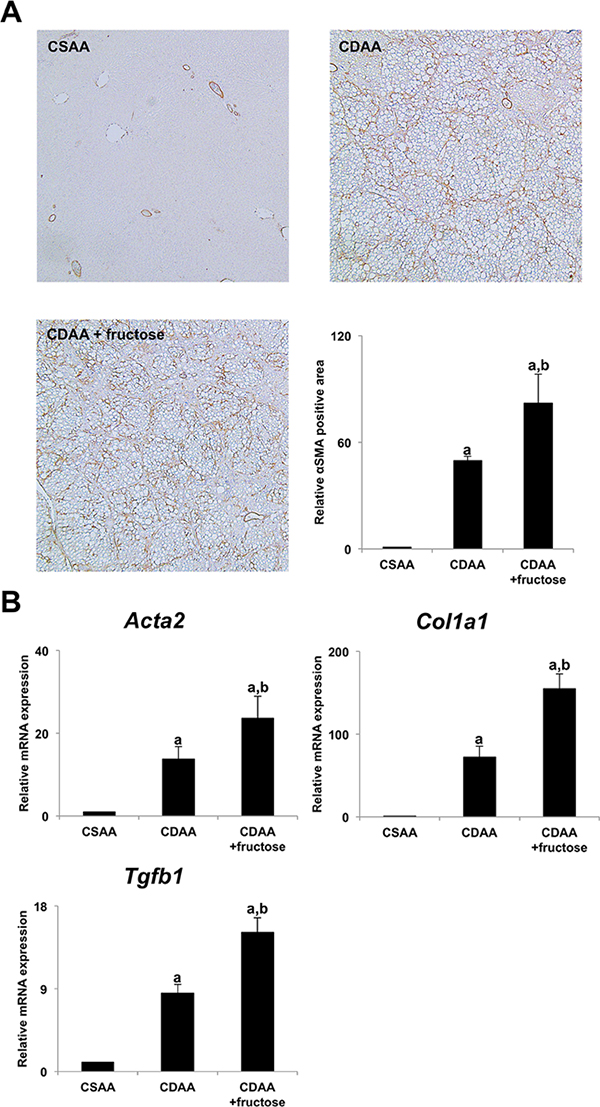 Fructose accelerated hepatic stellate cells-induced liver fibrogenesis.